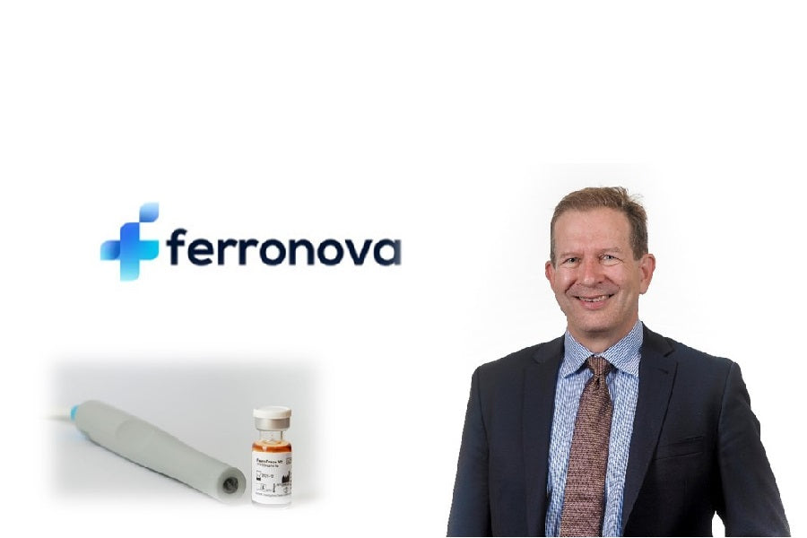 Meet the CEO - Stewart Bartlett